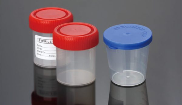 Urine Container