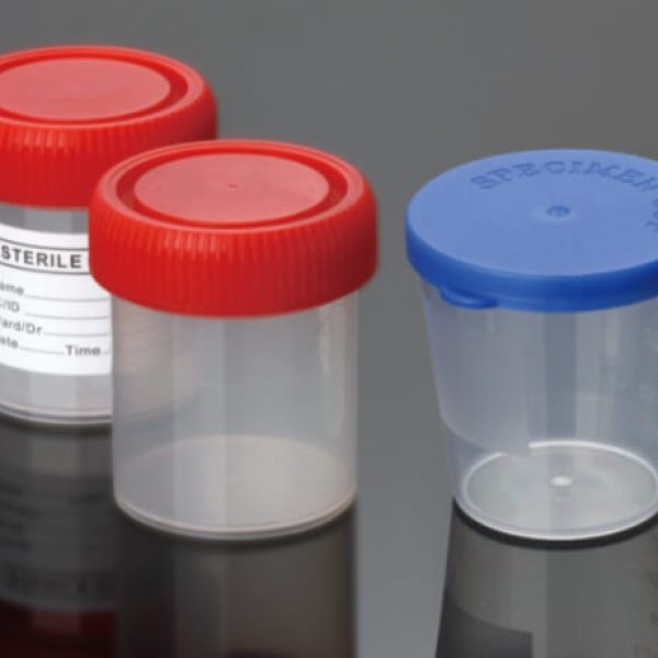 Urine Container