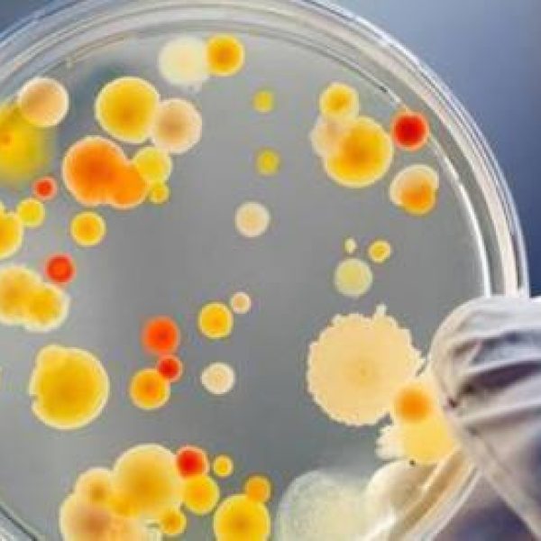 Professional microbial rapid derection solutions